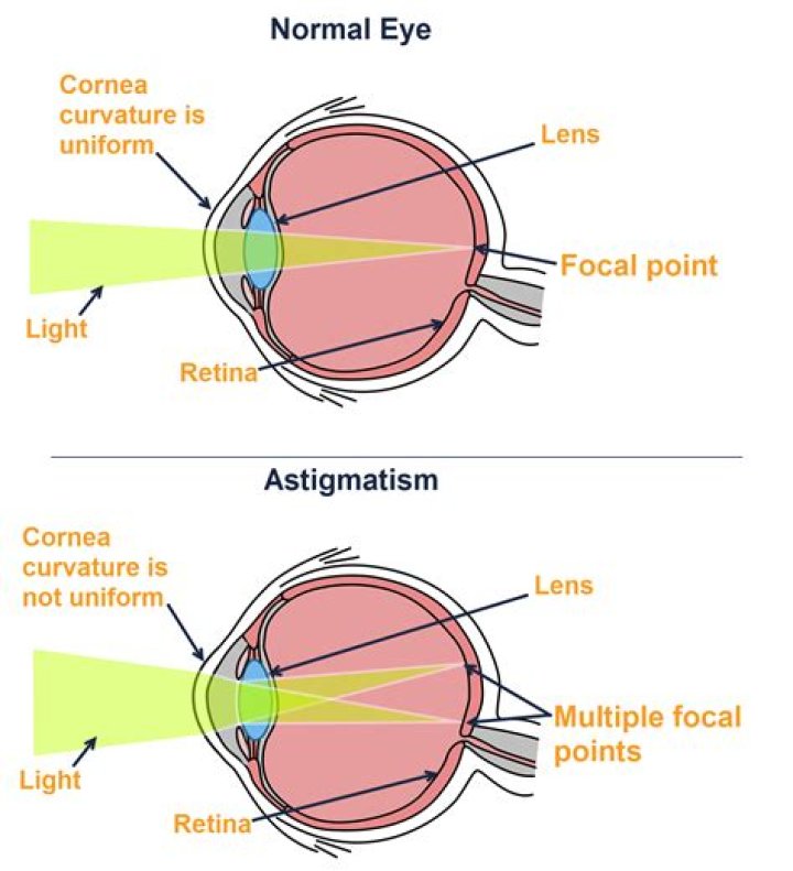 Uncover The Nighttime Driving Secrets For Astigmatism: A Revolutionary Guide